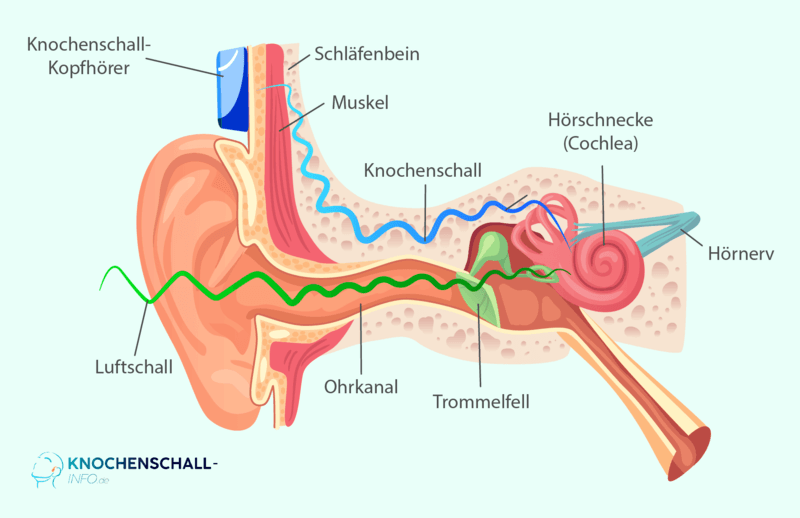 Infografik Wie funktionieren Knochenschall Kopfhörer
